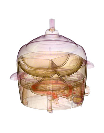 Illustration for article titled CT Scanner Bares Apple Notebook, PS3, and Big Mac to Their Core